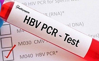 15 ülke ve Hong Kong'dan Türkiye'ye gelenler için PCR testi zorunluluğu kaldırıldı